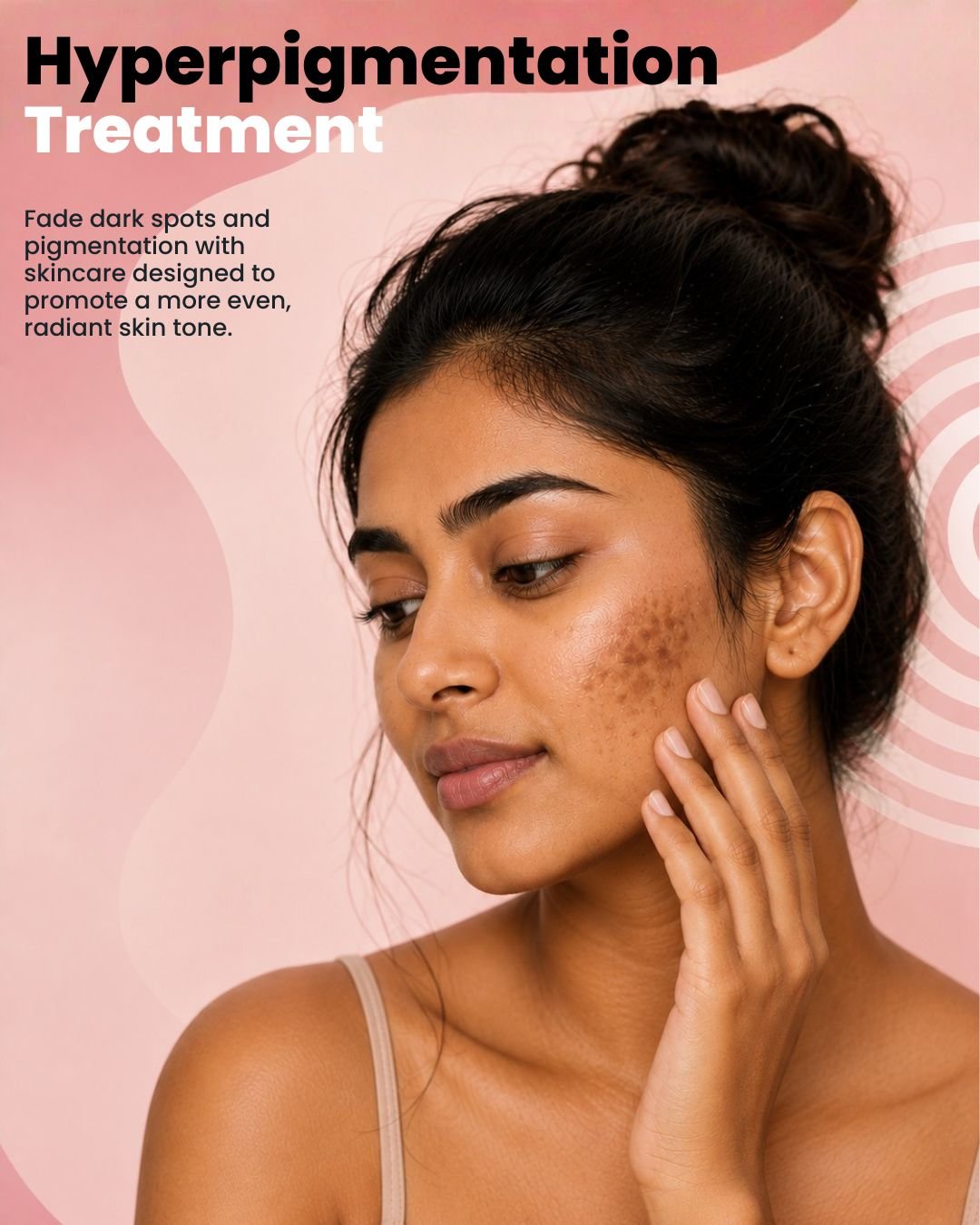 Professional facial treatment for reducing hyperpigmentation, dark spots, acne marks, and uneven pigmentation.